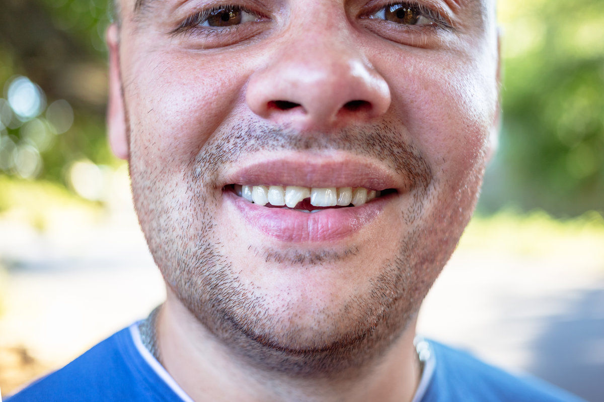 Young man in a blue T-shirt with a chipped tooth