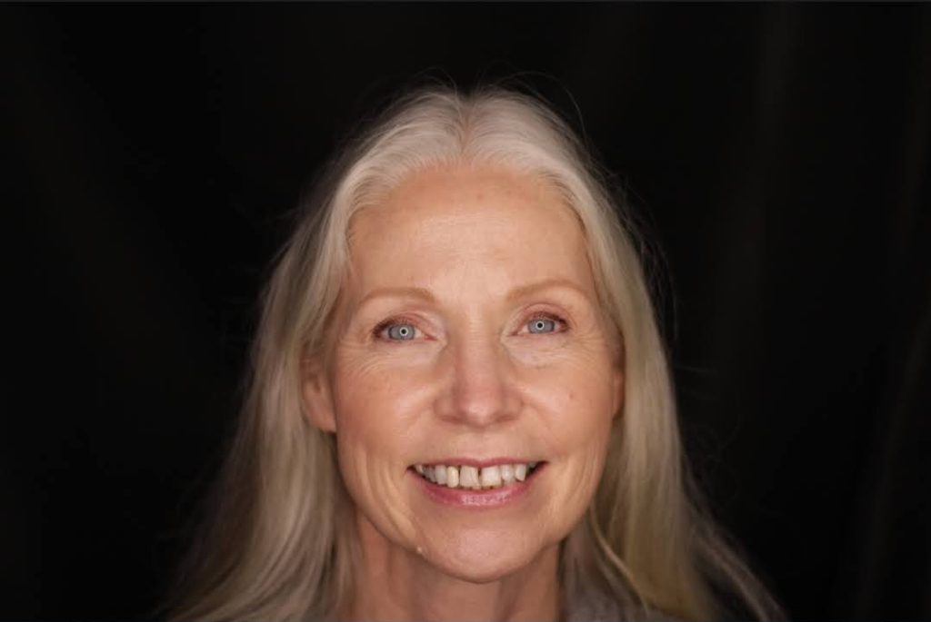 Older woman with gray hair smiling before dental treatment