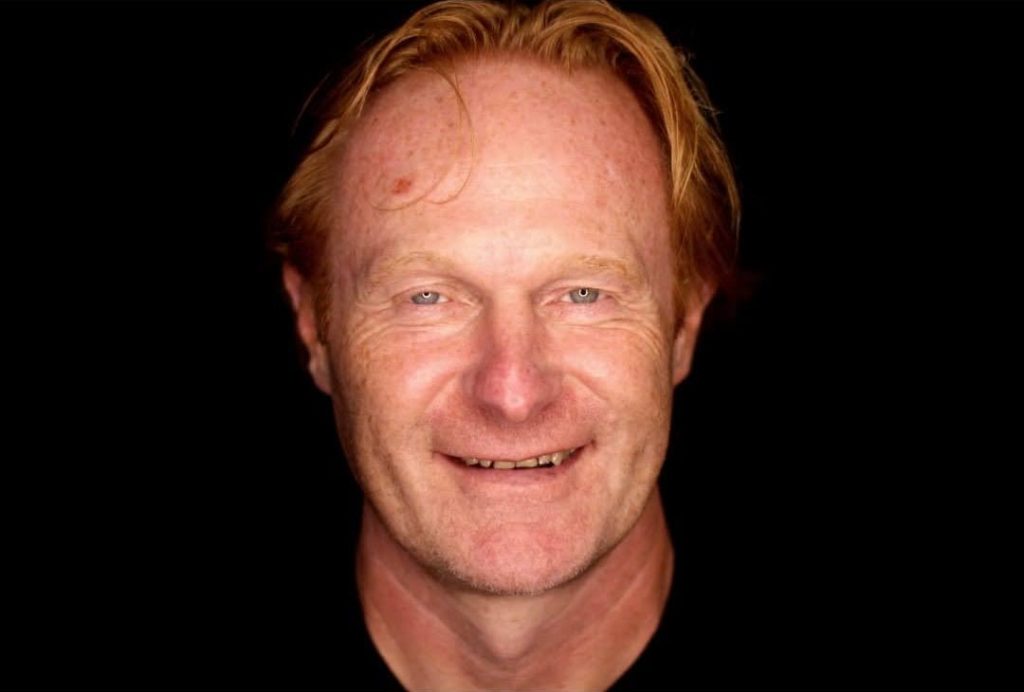 Man with reddish hair smiling before dental treatment at Evergreen Grace Dental Care