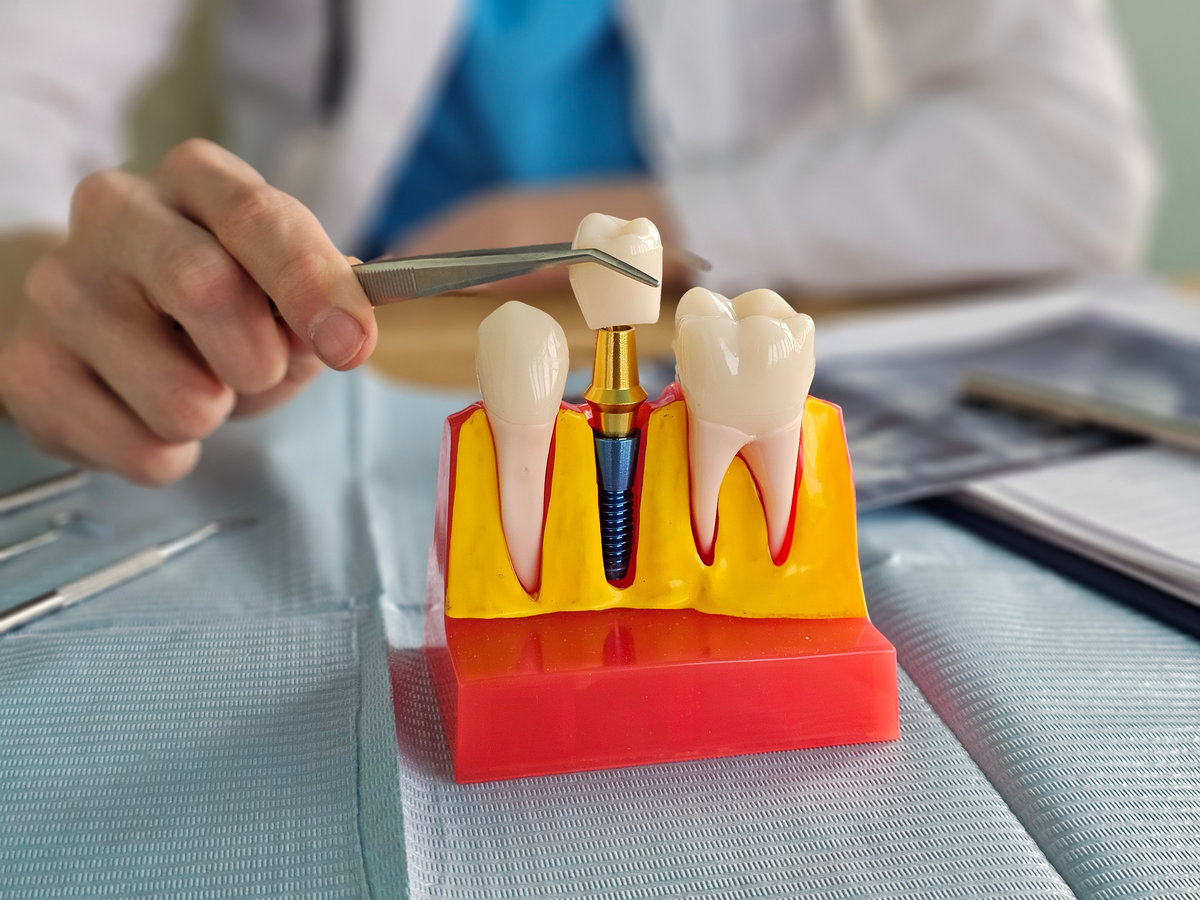 A hand holds tools while working on a dental model that shows teeth and an implant in a clinic. The setting is organized with equipment for dental treatment and care.